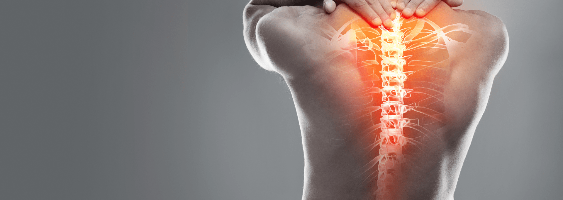 PRT - Periradikuläre Rückenschmerztherapie