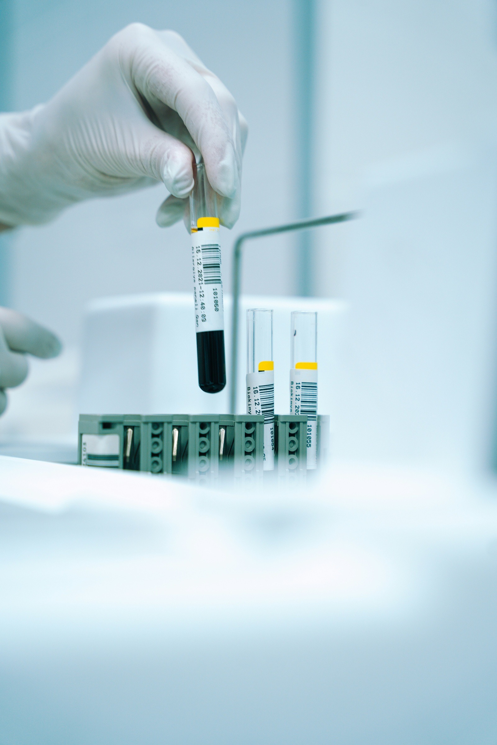 ACP/PRP – Therapie Bild