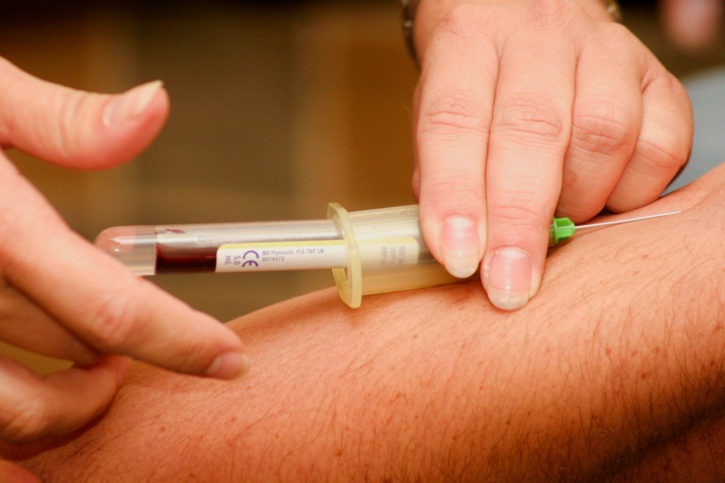ACP/PRP – Therapie Bild